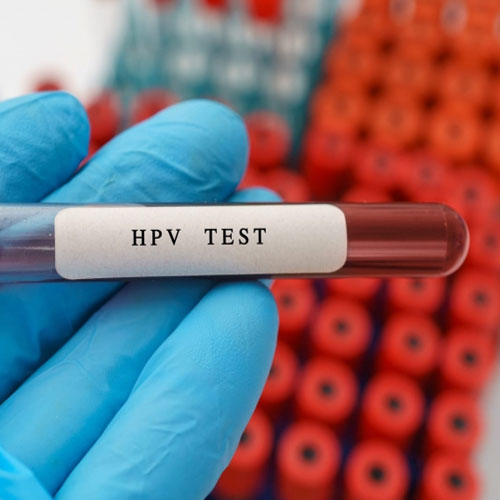 تست HPV