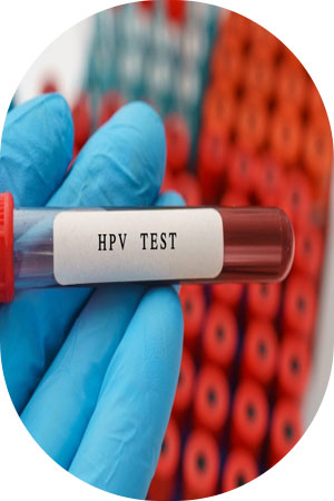 تست HPV