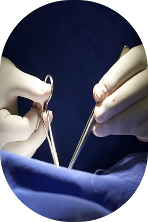 تصویر-انواع-روش-های-جراحی-لابیاپلاستی-8432